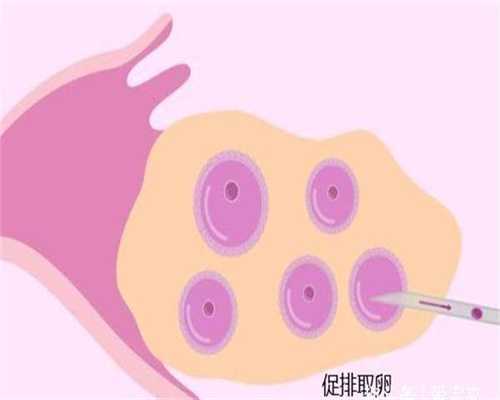 北京代孕机构正规吗：甲亢甲减患者是不是感觉自己眼睛肿、脖